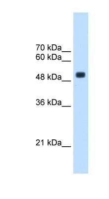 Western Blot: TRMT2B Antibody [NBP1-55171]