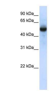 Western Blot: TRMT2B Antibody [NBP1-55232]