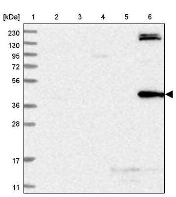 Western Blot: TRMT2B Antibody [NBP1-85370]