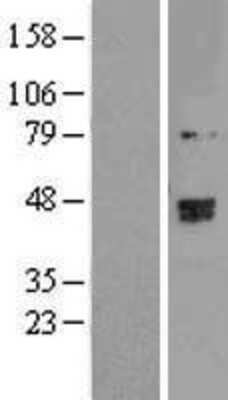 Western Blot: TRMT2B Overexpression Lysate [NBP2-06272]