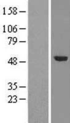 Western Blot: TRMT5 Overexpression Lysate [NBL1-17324]