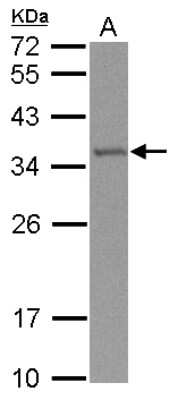 Western Blot: TRMT61A Antibody [NBP2-20728]