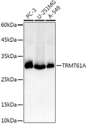 Western Blot: TRMT61A AntibodyAzide and BSA Free [NBP2-94200]