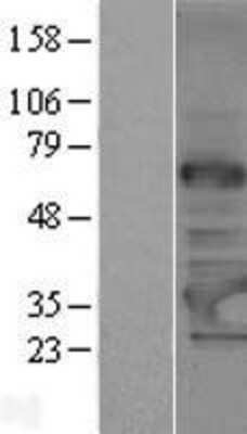 Western Blot: TRMT61A Overexpression Lysate [NBP2-05408]