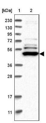 Western Blot: TRMT61B Antibody [NBP1-83640]