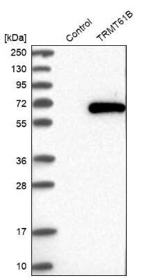 Western Blot: TRMT61B Antibody [NBP1-83641]