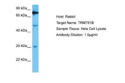 Western Blot: TRMT61B Antibody [NBP2-88485]