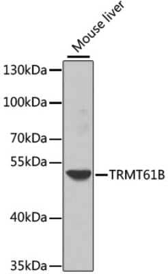 Western Blot: TRMT61B AntibodyBSA Free [NBP2-93769]