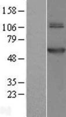 Western Blot: TRMT61B Overexpression Lysate [NBL1-10756]