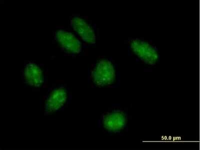 Immunocytochemistry/ Immunofluorescence: TRMT9B Antibody [H00057604-B01P]