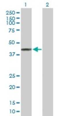 Western Blot: TRMT9B Antibody [H00057604-B01P]