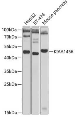 Western Blot: TRMT9B AntibodyBSA Free [NBP2-93012]