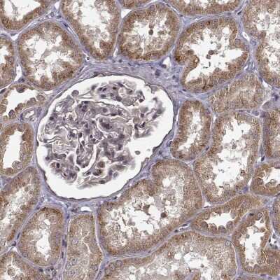 Immunohistochemistry: TRMU Antibody [NBP2-68574]