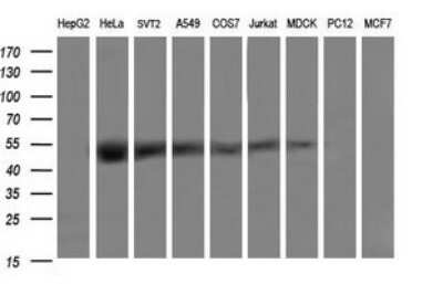 Western Blot: TRMU Antibody (OTI2A4) [NBP2-46016]