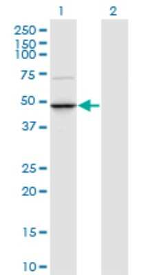 Western Blot: TRNT1 Antibody (1G11) [H00051095-M01]