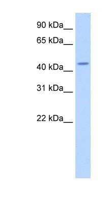 Western Blot: TRNT1 Antibody [NBP1-57224]