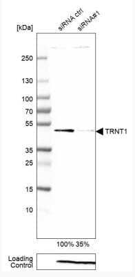 Western Blot: TRNT1 Antibody [NBP1-86589]