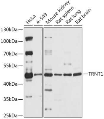 Western Blot: TRNT1 AntibodyAzide and BSA Free [NBP2-94361]