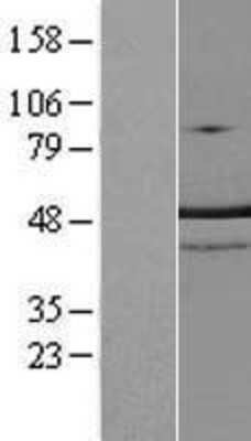 Western Blot: TRNT1 Overexpression Lysate [NBL1-17327]