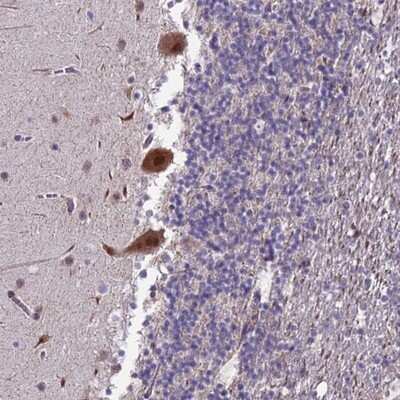 Immunohistochemistry-Paraffin: TROAP Antibody [NBP1-92532]