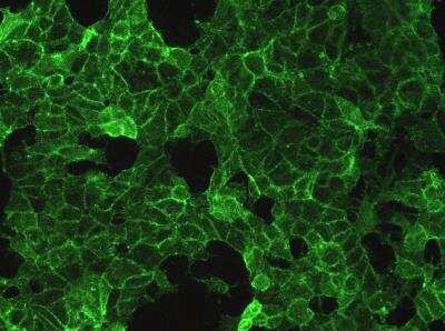 Immunocytochemistry/ Immunofluorescence: TROP-2 Antibody (001) [NBP2-89492]
