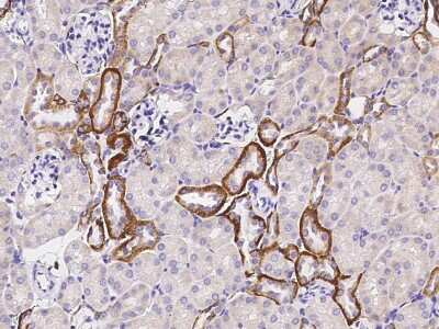 Immunohistochemistry-Paraffin: TROP-2 Antibody (046) [NBP2-90742]