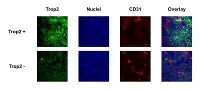 Immunohistochemistry-Frozen: TROP-2 Antibody [NBP1-92533]