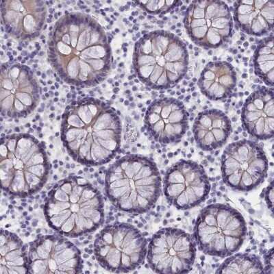 Immunohistochemistry-Paraffin: TROP-2 Antibody [NBP1-92533]