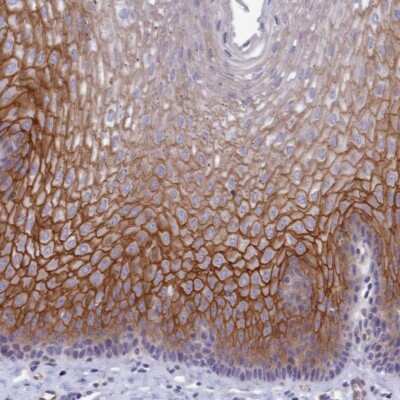 Immunohistochemistry-Paraffin: TROP-2 Antibody [NBP1-92533]