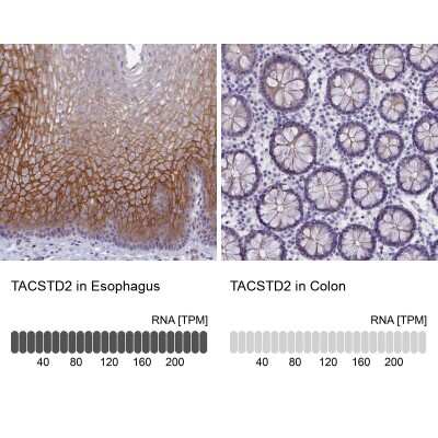 Immunohistochemistry-Paraffin: TROP-2 Antibody [NBP1-92533]