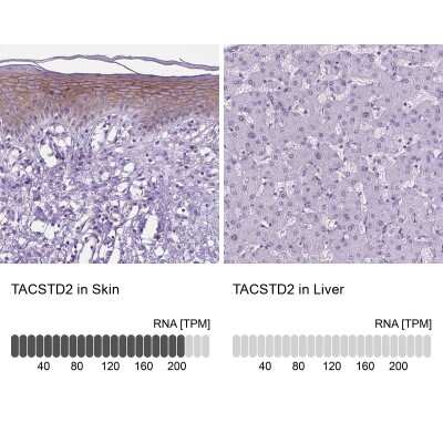 Immunohistochemistry-Paraffin: TROP-2 Antibody [NBP2-49166]