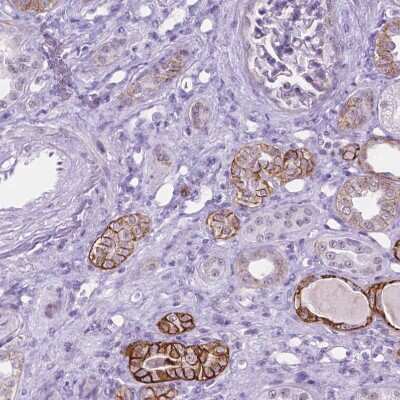 Immunohistochemistry-Paraffin: TROP-2 Antibody [NBP2-49166]