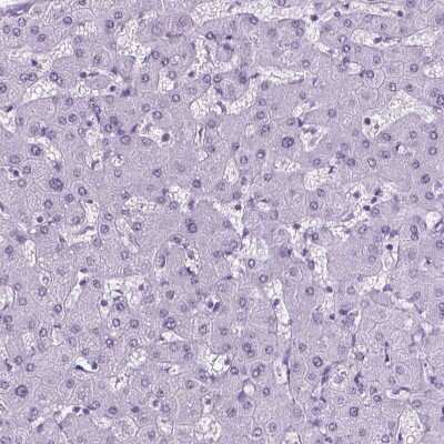 Immunohistochemistry-Paraffin: TROP-2 Antibody [NBP2-49166]