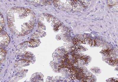 Immunohistochemistry-Paraffin: TROP-2 Antibody [NBP2-49166]