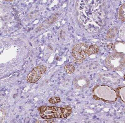 Immunohistochemistry-Paraffin: TROP-2 Antibody [NBP2-49166]