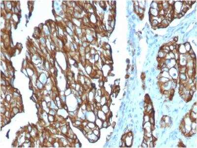 Immunohistochemistry-Paraffin: TROP-2 Antibody (TACSTD2/2151) - Azide and BSA Free [NBP2-75744]