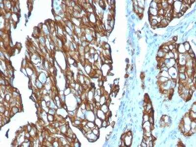 Immunohistochemistry-Paraffin: TROP-2 Antibody (TACSTD2/2151) [NBP2-75743]