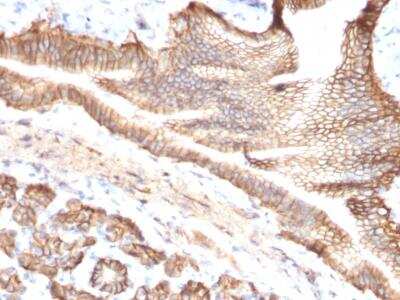 Immunohistochemistry-Paraffin: TROP-2 Antibody (TACSTD2/2151) [NBP2-75743]