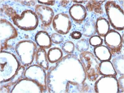 Immunohistochemistry-Paraffin: TROP-2 Antibody (TACSTD2/2151) [NBP2-75743]