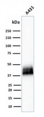 Western Blot: TROP-2 Antibody (TACSTD2/2151) [NBP2-75743]