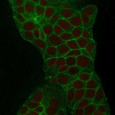 Immunocytochemistry/ Immunofluorescence: TROP-2 Antibody (TACSTD2/2152) - Azide and BSA Free [NBP2-75746]