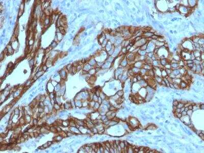 Immunohistochemistry-Paraffin: TROP-2 Antibody (TACSTD2/2152) - Azide and BSA Free [NBP2-75746]