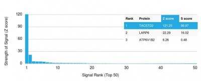 Protein Array: TROP-2 Antibody (TACSTD2/2152)Azide and BSA Free [NBP2-75746]
