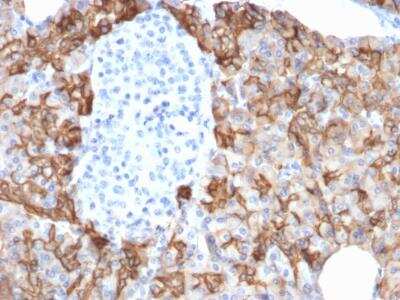 Immunohistochemistry-Paraffin: TROP-2 Antibody (TACSTD2/2152) [NBP2-75745]