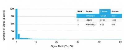Protein Array: TROP-2 Antibody (TACSTD2/2152) [NBP2-75745]