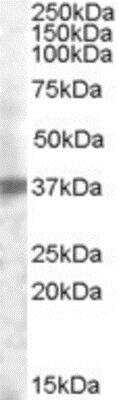 Western Blot: TROP-2 Antibody [NBP1-05036]