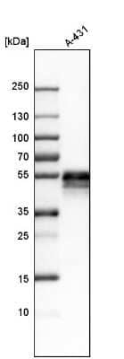 Western Blot: TROP-2 Antibody [NBP1-92533]