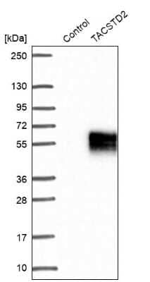 Western Blot: TROP-2 Antibody [NBP1-92533]