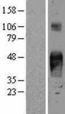 Western Blot: TROP-2 Overexpression Lysate [NBL1-16675]