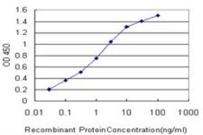 ELISA: TROVE2 Antibody (1F2) [H00006738-M03]